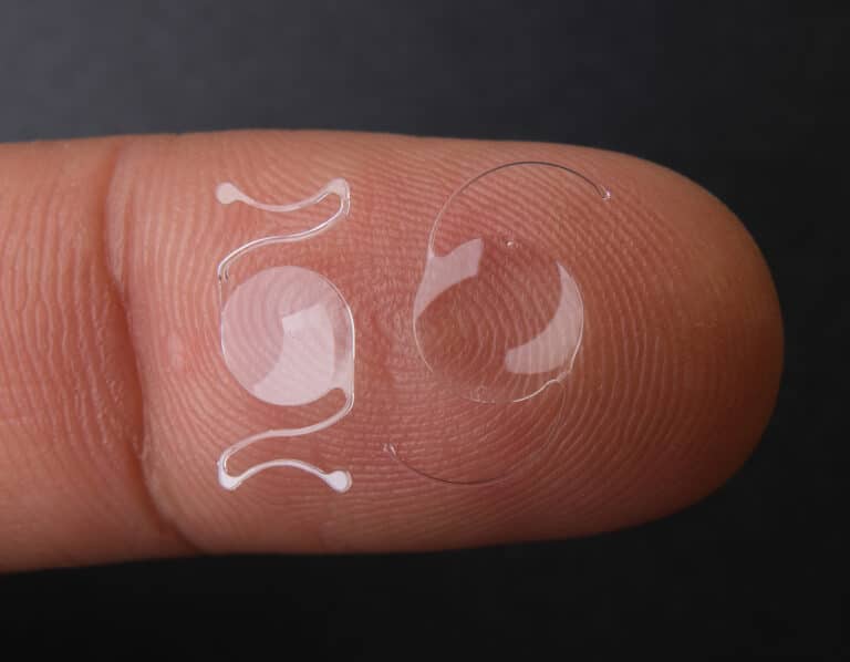 Refractive Lens Exchange (RLE) in the Hudson Valley